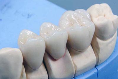 Сколько стоит вставить зубы